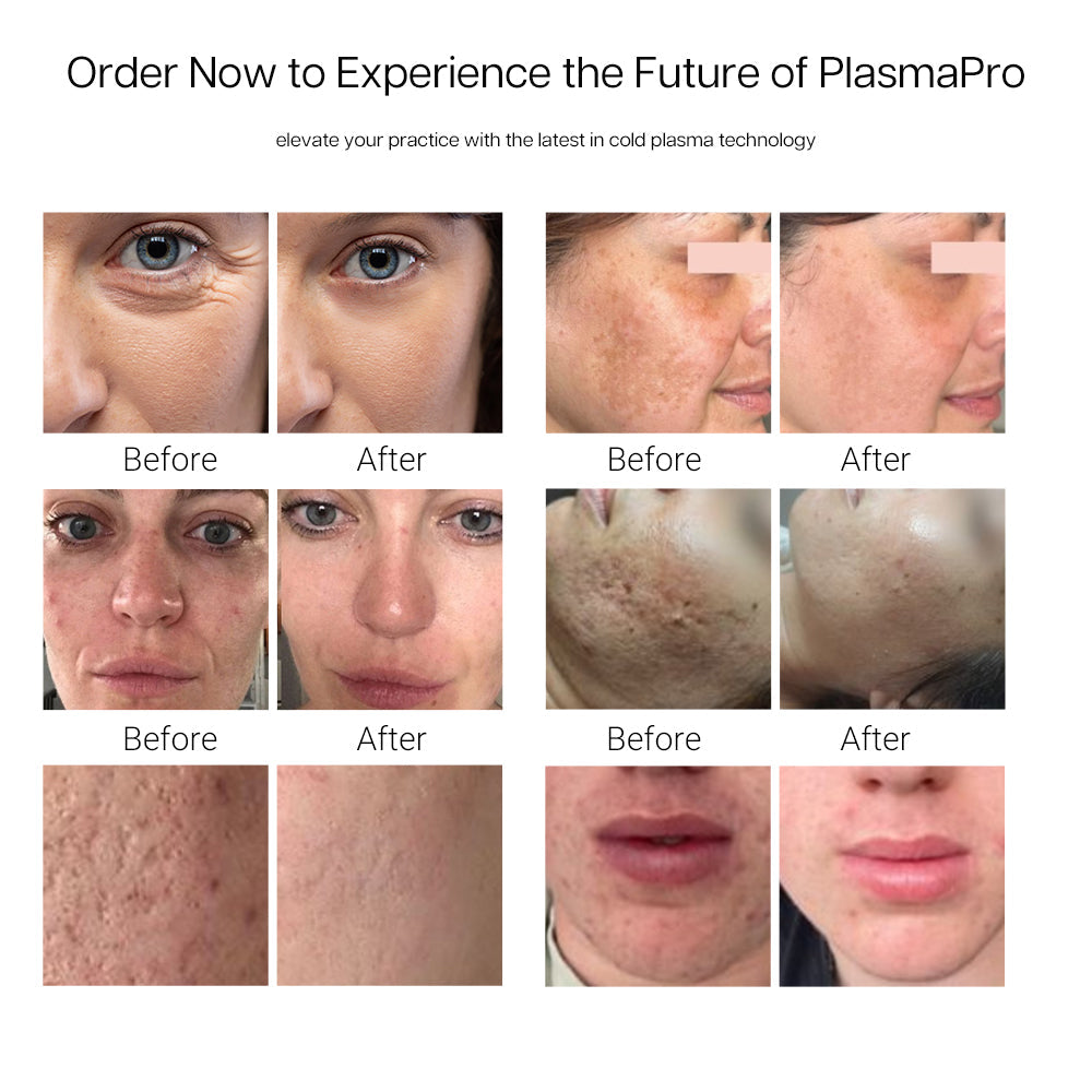 cold_plasma_machine effect